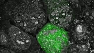 Adenovirus infection in osteosarcoma cells under Nanolives 3D Cell ExplorerFluo [upl. by Patsy]