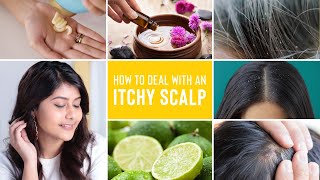 Itchy Scalp Treatments  Remedies For Dandruff Lice and Scalp Acne [upl. by Vasili]