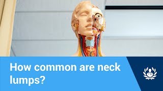 How common are neck lumps [upl. by Aseek467]