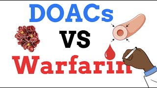 DOACs vs Warfarin  WHEN TO USE ONE vs THE OTHER [upl. by Phira728]