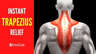 How to Fix Upper Trapezius Pain FOR GOOD [upl. by Eerrehc]