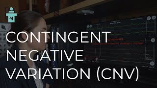 What is Contingent negative variation CNV A series of lectures on evoked potentials [upl. by Omocaig]