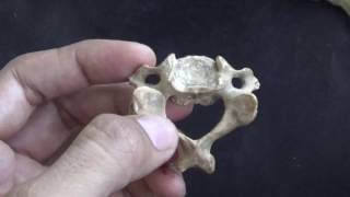 CERVICAL VERTEBRAE  QUICK IDENTIFICATION POINTS [upl. by Hubie518]