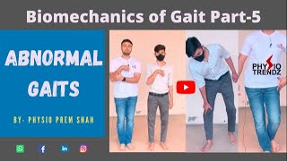 Antalgic gait Hemiplegic gait All Abnormal Gait Demonstration Gait biomechanics [upl. by Togram]