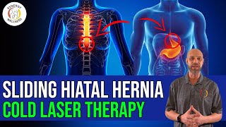 Sliding Hiatal Hernia NonSurgical Treatment and Cold Laser Therapy [upl. by Aitak422]