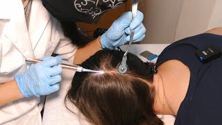 ASMR Scalp Check amp Hairline Exam with Sensory Tests Real Person [upl. by Whang14]