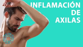 CAUSAS de las AXILAS INFLAMADAS [upl. by Montana]