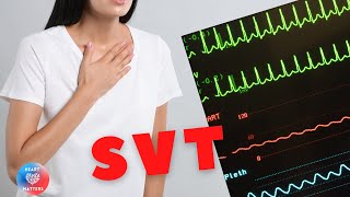 Supraventricular Tachycardia  SVT [upl. by Mountfort]