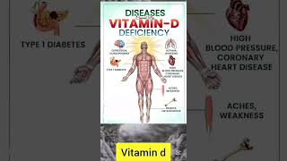 Diseases caused by deficiency of vitamin D [upl. by Yetah473]