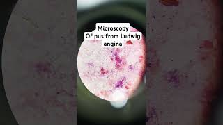 Microscopy1 infection microscope drmicro [upl. by Mientao]