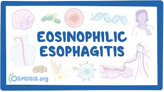 Eosinophilic esophagitis NORD [upl. by Natsirc327]