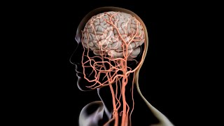 How to pull a clot from the brain  Science News [upl. by Ellerud]