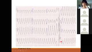 M6P2 Curso de electrocardiografía clínica “Prof Hiram Collard”  Cát de Semiología HNCFCMUNC [upl. by Danya]