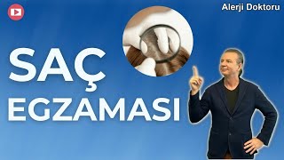 Saç Egzaması Nedir  Prof Dr Ahmet Akçay [upl. by Kata]