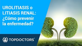 UROLITIASIS o LITIASIS RENAL ¿Cómo prevenir la enfermedad [upl. by Perlis]