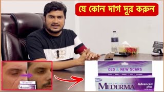 Mederma Advanced Scar Removal Gel  অপারেশন এর দাগ দ্রুতগতিতে দূর করে যে ক্রিম  Scar Removal Cream [upl. by Odab]