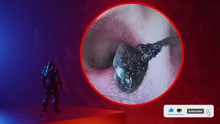 The Truth About earwax Will Shock You How to remove earwax from ear earwax extractions [upl. by Refinej]