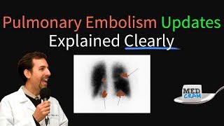 Pulmonary Embolism  Thromboembolism Updates Explained Clearly [upl. by Morez]