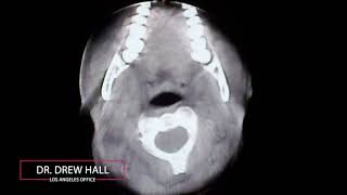 Cone Beam Computerized Tomography CBCT Explained [upl. by Ymeraj]