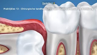 Praktijkles 13  Chirurgische tandheelkunde voor tandartsassistenten [upl. by Zzabahs982]