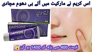 How I Cured my severe Acne  Its time to get Clear Acne Free skin  Dapsone Gel Acne Treatmentacne [upl. by Ttekcirc808]