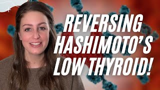 Hashimotos Disease Treatment and Ongoing Care for Hypothyroidism [upl. by Annaiviv]