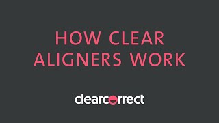 How clear aligners work [upl. by Hamon674]