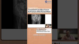 Cannulated Cancellous Screws for Femoral Neck Fractures  Dr Shailesh Pai  Surgical Series [upl. by Khalid]