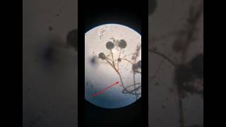 Mucor  mold  Saprophytic  fungus c³ experiment [upl. by Liebermann176]