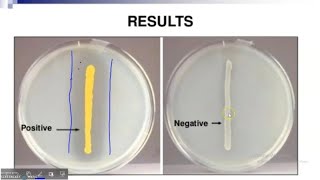 DNase test principle procedure results [upl. by Enirbas]