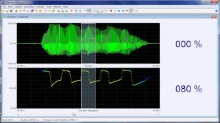 Measuring nasality with the Nasality Microphone [upl. by Blithe]