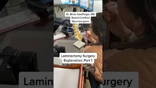 Laminectomy Surgery Explanation with Model doctor healthcare learning [upl. by Brockwell]