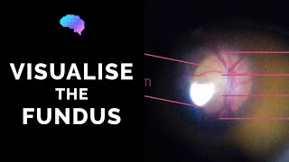 Fundoscopy  How to Visualise the Fundus  Direct Ophthalmoscopy  OSCE Guide  UKMLA  CPSA [upl. by Kit]