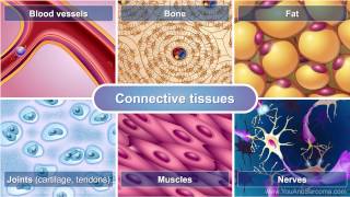 Understanding Soft Tissue Sarcoma [upl. by Nauqyaj]