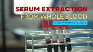 Serum Extraction from Whole Blood [upl. by Florina372]