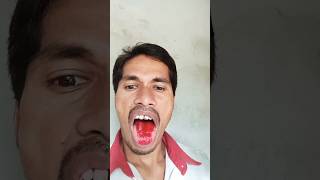 😱खून निकला shorts funnyshorts assamcocktailboy [upl. by Edita]