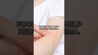 Foods that help reduce eczema🌱🐟 EczemaRelief HealthySkin NaturalRemedies NourishYourSkin [upl. by Lam972]