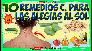 10 Remedios Para Alergias del SolREMEDIOS CASEROS PARA LAS ALERGIAS EN LA PIEL [upl. by Clifford]