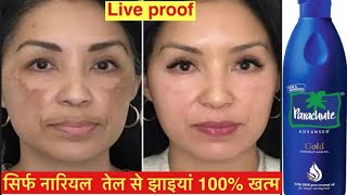 नारियल तेल में बस 1 चीज़ मिलने से झाइयों को जड़ से ख़त्म करें Pigmentation Removal [upl. by Becka]