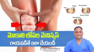 Meniscus Tear Injury Treatment In Telugu  Knee Injury  Dr Manoj Chakravorthy  Healthy Bones [upl. by Nester]