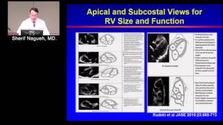 Assessment of RV Function Sherif Nagueh MD February 14 2017 [upl. by Norm]