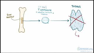 Digeorge Syndrome Osmosis [upl. by Lotson]