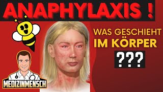 ANAPHYLAKTISCHER SCHOCK Was Passiert Im Körper  Arzt erklärt [upl. by Adnirem]