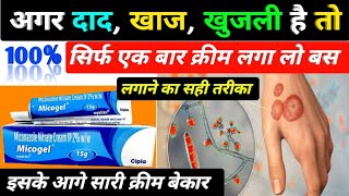 दाद खाज खुजली की बेस्ट क्रीम  micogel cream  micogel cream uses in hindi  miconazole nitrate [upl. by Heck]