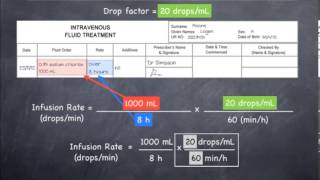 Calculating infusion rates in dropsmin 20 dropsmL [upl. by Eekram]