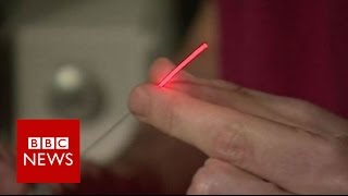 Prostate cancer laser treatment truly transformative  BBC News [upl. by Cynarra]