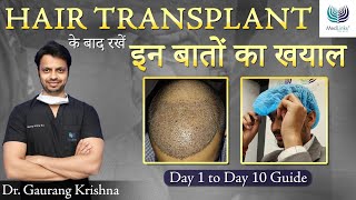 How to Spend the First 10 Days After Hair Transplant  Precautions after Hair Transplant  Medlinks [upl. by Faus]