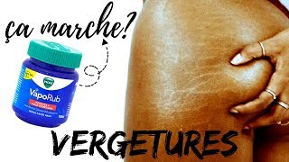 VERGETURES LA VÉRITÉ SUR LE VICKS VAPORUB [upl. by Rosabel]