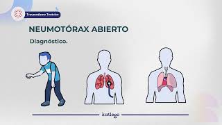 Clase de Medicina Traumatismo torácico  Curso ENARM [upl. by Rowan]