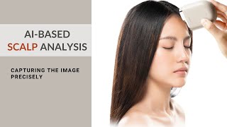 How to capture the image  Scalp analysis [upl. by Annonyw895]